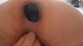 prolapse fucking6 fisting extreme anal Bang cupid anal homemade